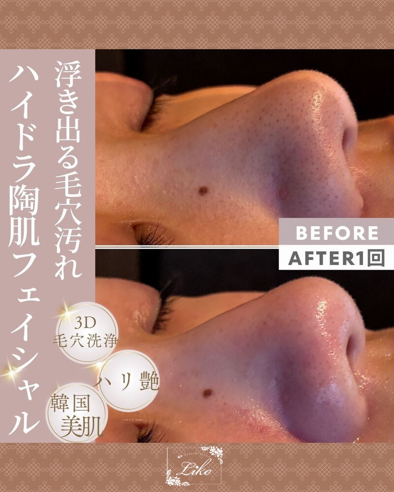 ブログ