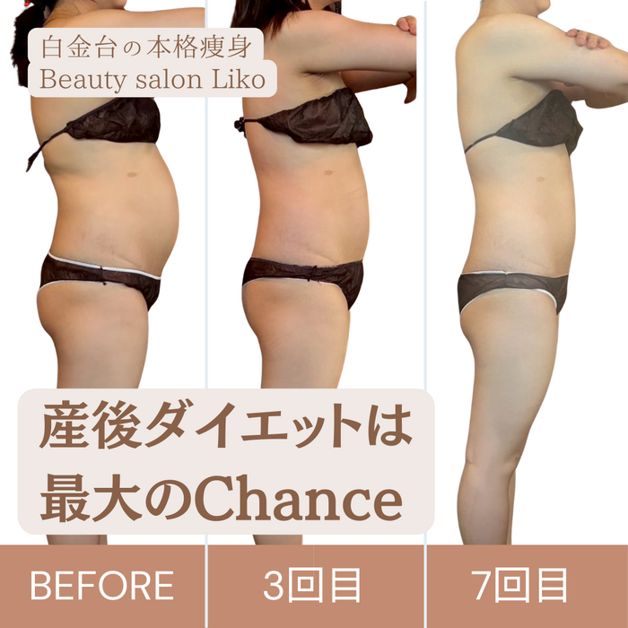 画像4004：医療レベルのスキンケア