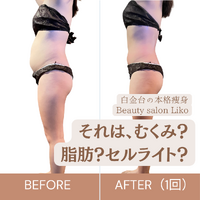 画像4008：医療レベルのスキンケア