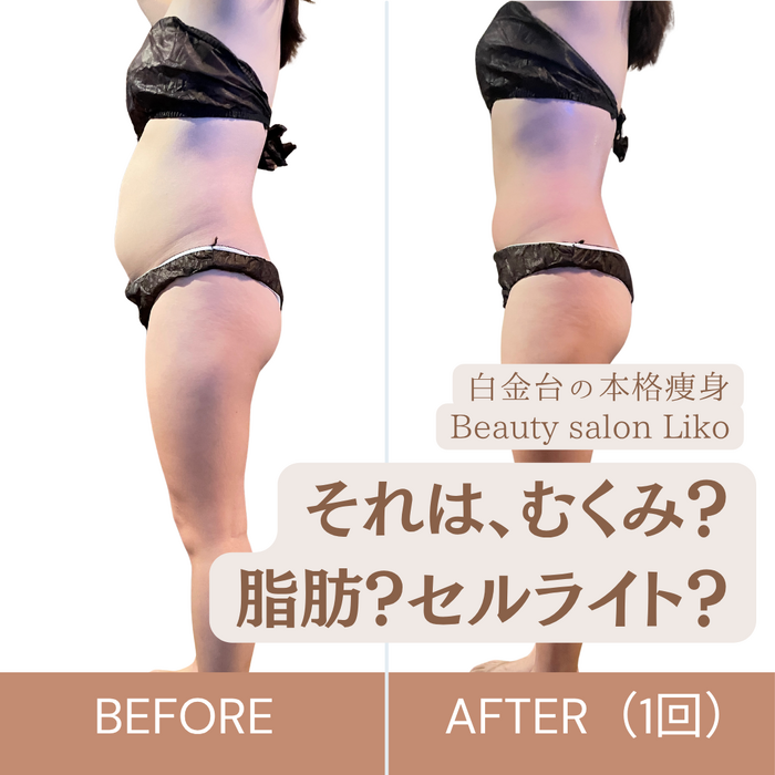 画像4008：医療レベルのスキンケア