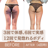 画像4009：医療レベルのスキンケア