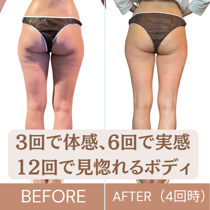 画像4009：医療レベルのスキンケア