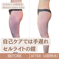 画像4012：医療レベルのスキンケア